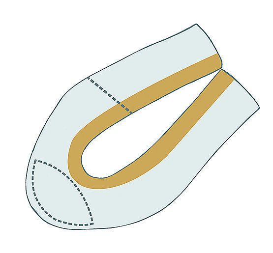 NST Nyco 4 mm Ecru Yapışkanlı Polyester Bant 50 Mt - 3